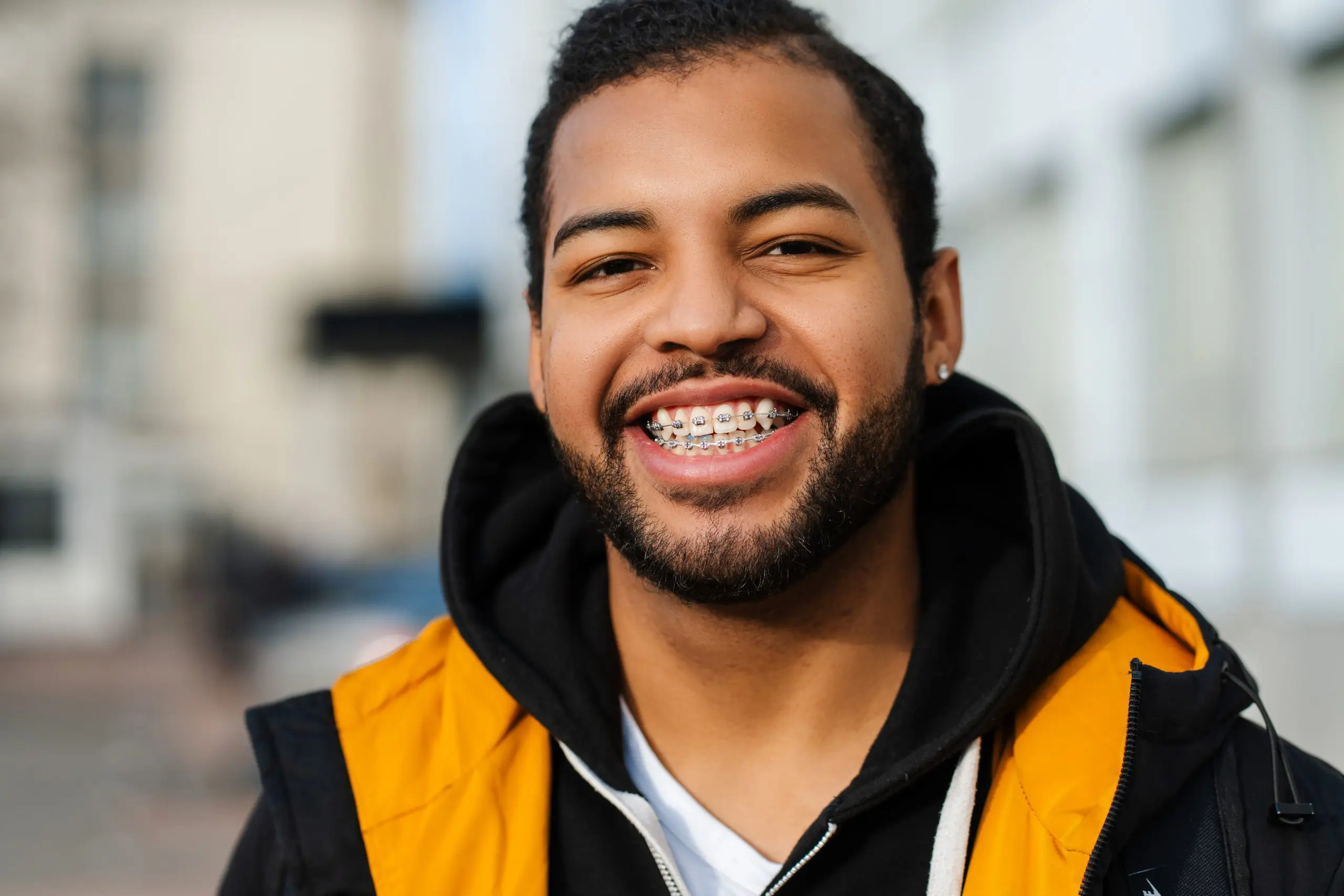 A bearded young man with an underbite, wearing braces, a black hoodie, and a yellow jacket, smiles outdoors an example of the confident results achieved at Star Smiles Orthodontics and Pediatric Dentistry in Bloomingdale and Naperville, IL.