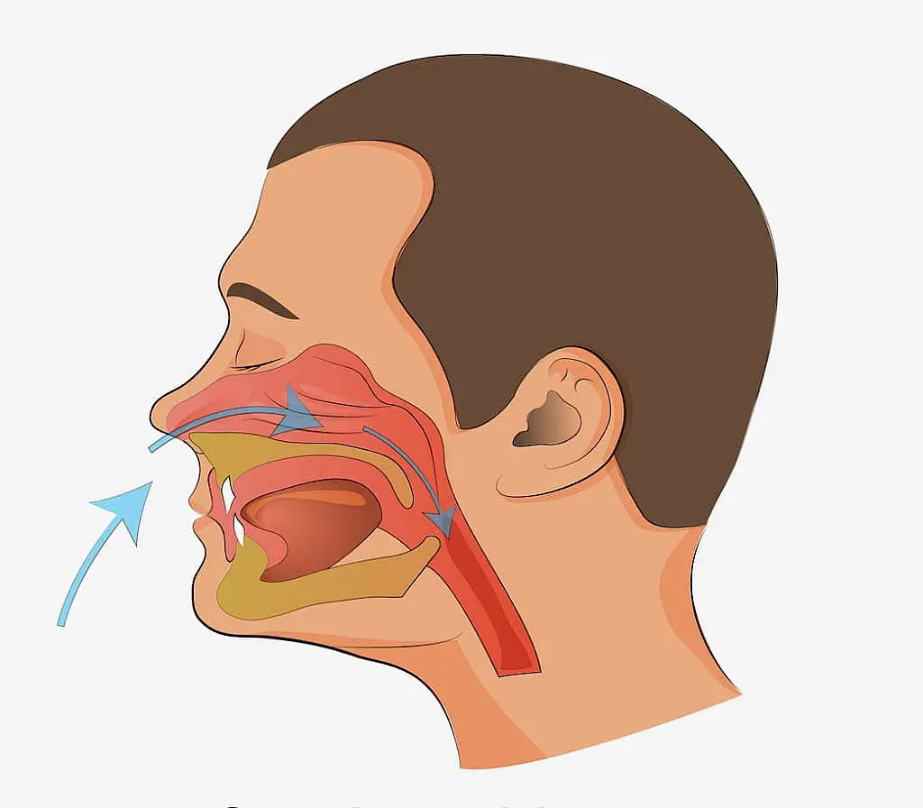 A diagram of a human head profile illustrates the nasal cavity, mouth and throat passages with arrows showing airflow direction, highlighting a mouth breather’s airflow route. Available at Star Smiles Orthodontics and Pediatric Dentistry in Bloomingdale and Naperville, IL.