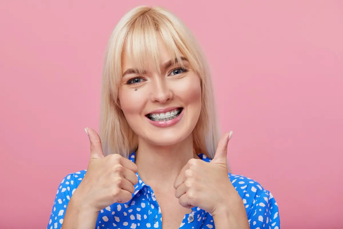 A woman showcases teeth with clear braces, expertly demonstrating the work of an orthodontist in Bloomingdale and Naperville, IL.