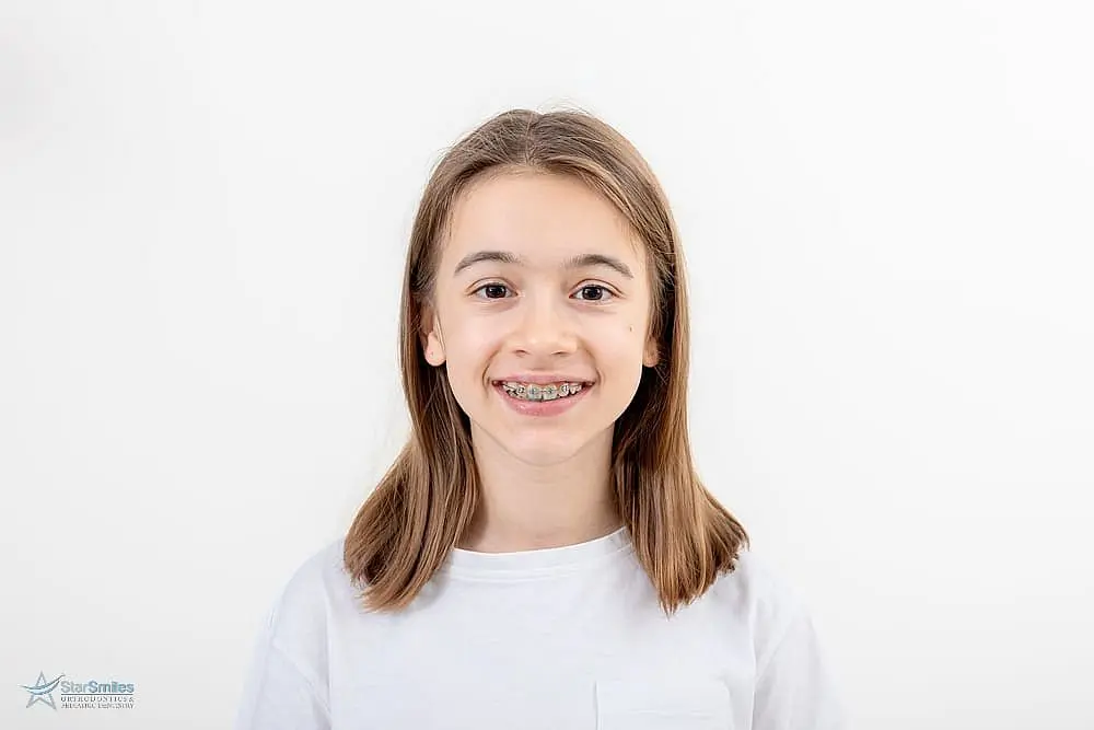 A smiling child with long brown hair, wearing a white shirt and braces, represents the kind of happy patient you’ll find at Star Smiles Orthodontics and Pediatric Dentistry in Bloomingdale or Naperville, IL.