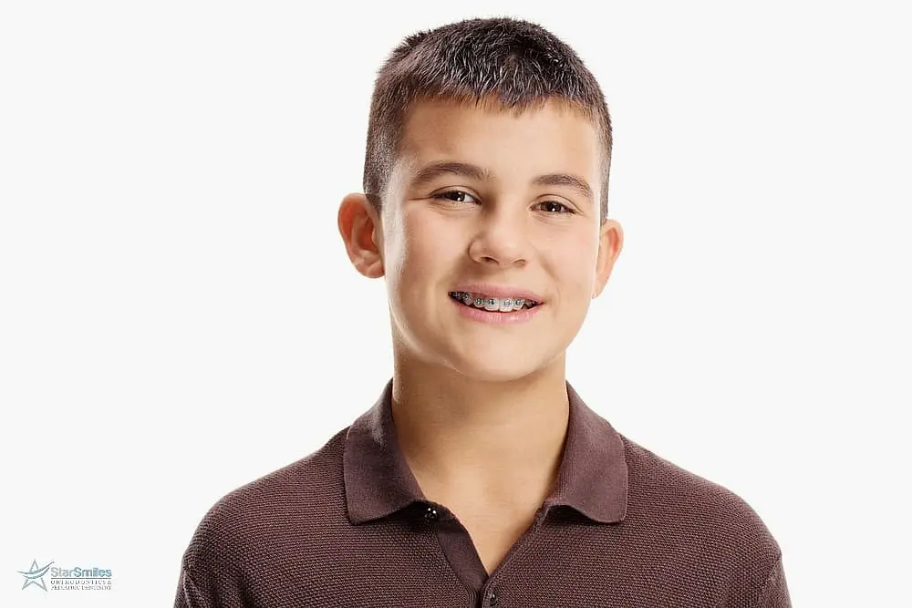 A boy with short dark hair, brown polo shirt, and braces smiles at the camera against a plain white background—an example of the confident results you can achieve at Star Smiles Orthodontics and Pediatric Dentistry in Bloomingdale or Naperville, IL.