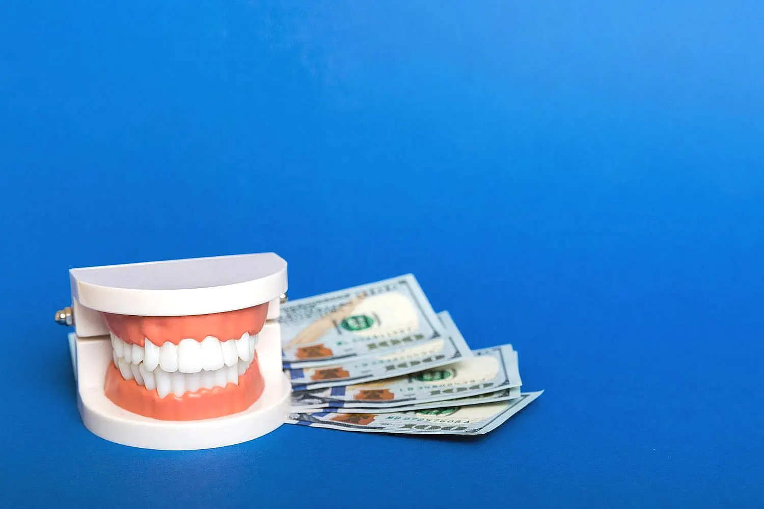 A dental model and several hundred-dollar bills are artfully arranged on a blue background, highlighting the value of investing in clear braces for a transformed smile in Bloomingdale and Naperville, IL.