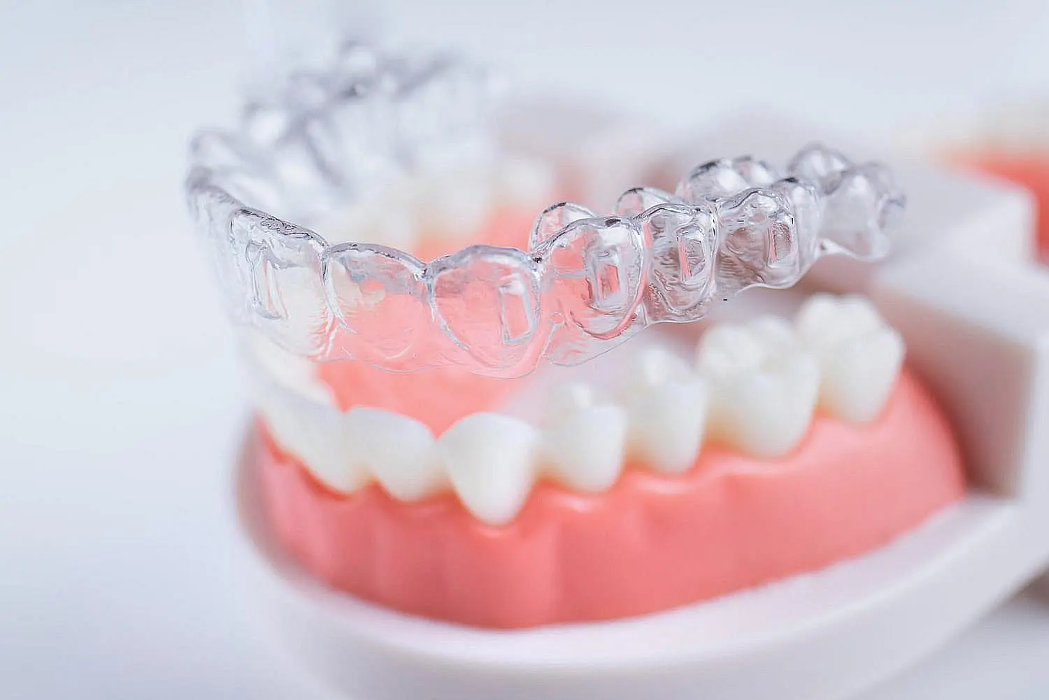 Affordable Invisalign with Invisalign payment plan options available at Star Smiles Orthodontics and Pediatric Dentistry in Bloomingdale and Naperville, IL.