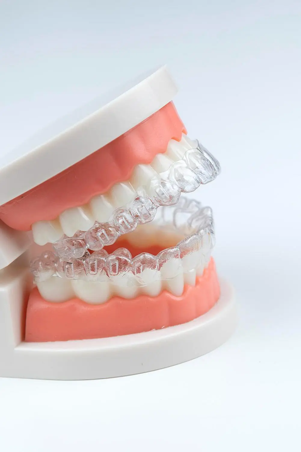 Clear aligners with Invisalign payment plan options available at Star Smiles Orthodontics and Pediatric Dentistry in Bloomingdale and Naperville, IL.