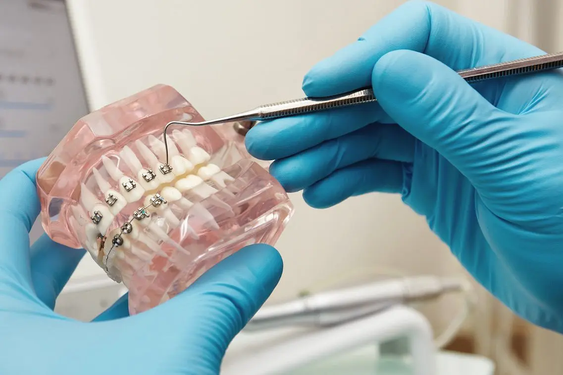 A dental professional hold model metal braces show advancements in braces technology at Star Smiles Orthodontics and Pediatric Dentistry located in Bloomingdale and Naperville, IL.