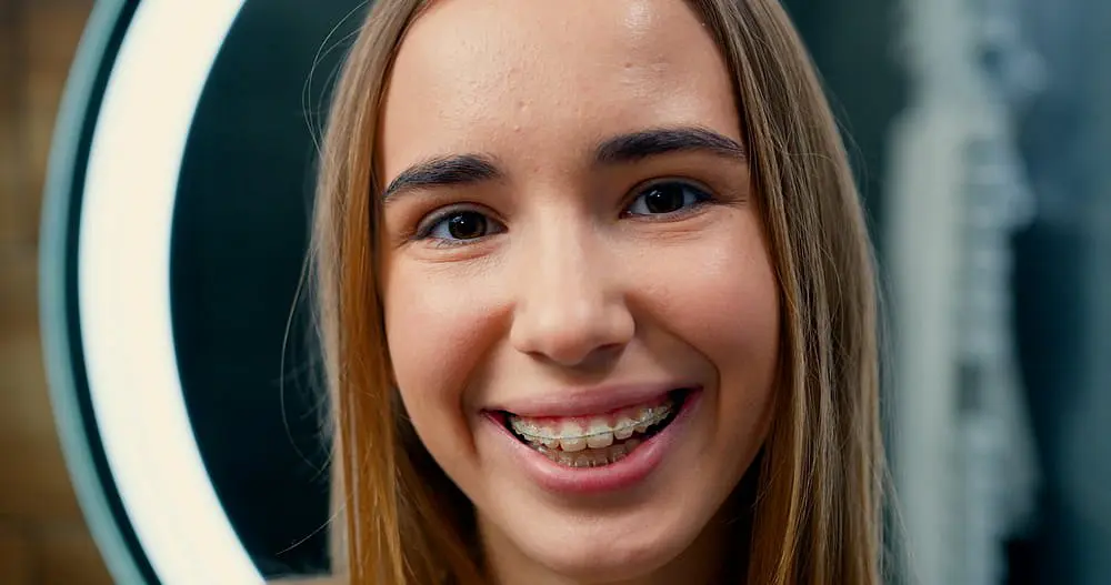 A young person with long hair and clear braces, smiling brightly in front of a circular light, represents the confidence gained from Star Smiles Orthodontics and Pediatric Dentistry in Bloomingdale and Naperville, IL.