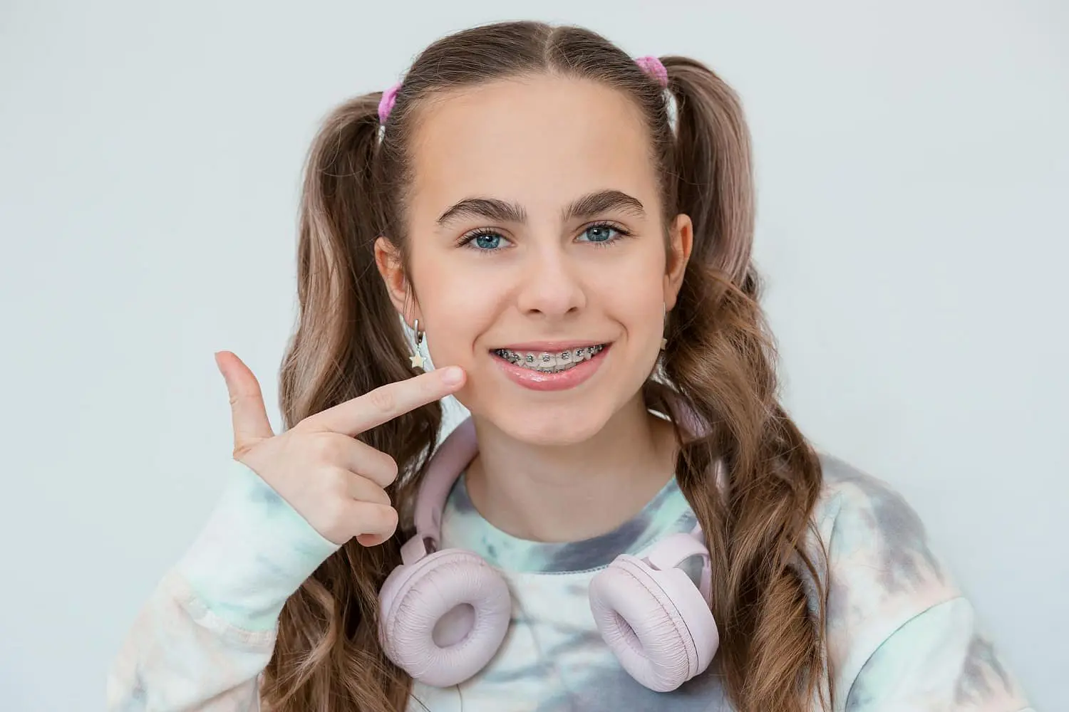A girl with braided pigtails and metal braces, wearing a tie-dye shirt, smiles while pointing at her teeth. She has pink headphones around her neck in Bloomingdale and Naperville, IL.
