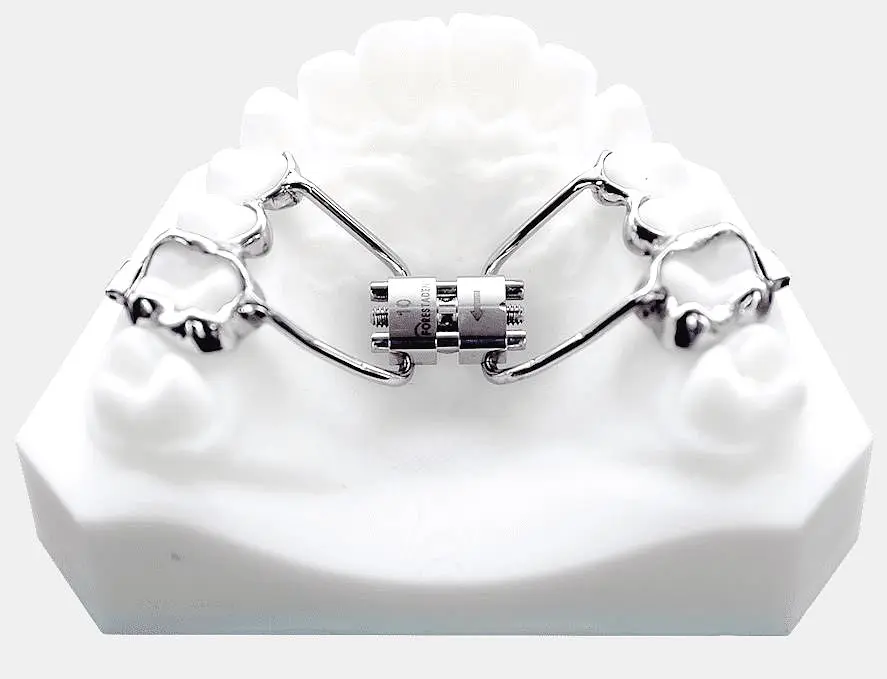Palatal Expander in Bloomingdale or Naperville IL