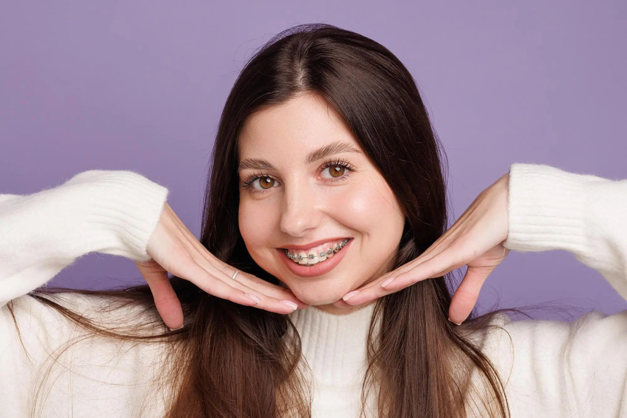 A Woman displays teeth with metal braces on both the upper and lower rows, crafted by a skilled orthodontist in Bloomingdale, IL.
