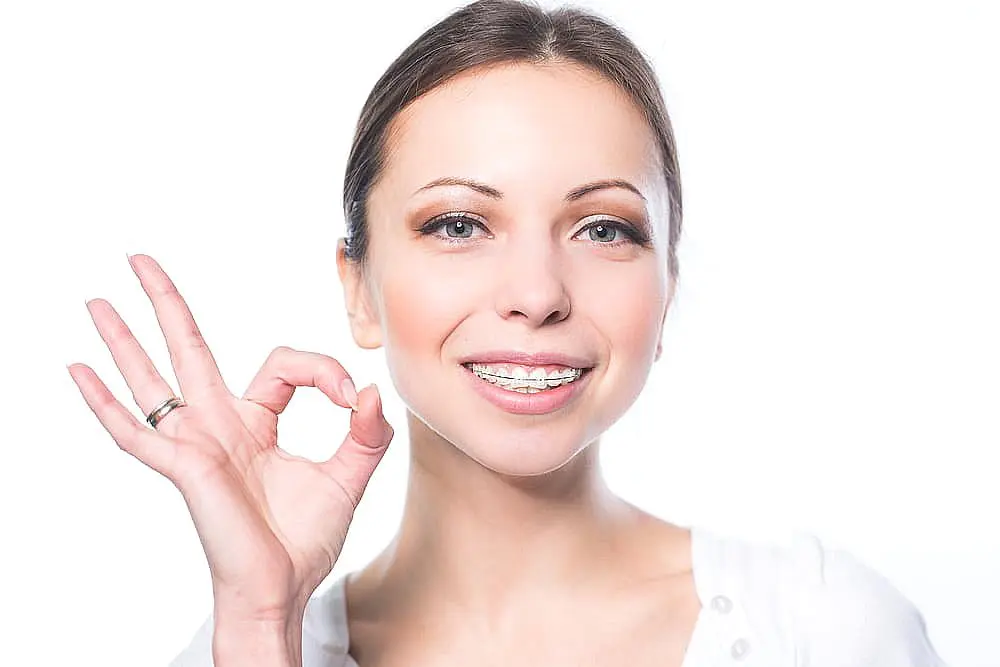 Close-up of a smiling person showcasing ceramic braces on their teeth in Naperville, IL.