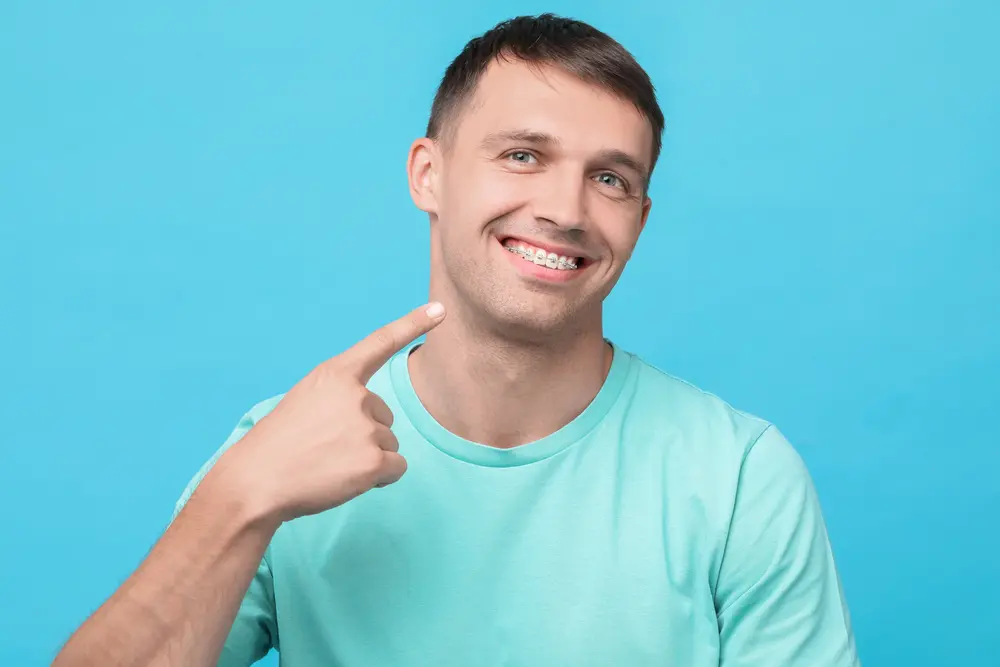 A man displays teeth with metal braces on both the upper and lower rows, crafted by a skilled orthodontist in Naperville, IL.