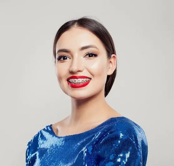 A woman surprised with result metal braces during their orthodontic treatment in Naperville, IL.