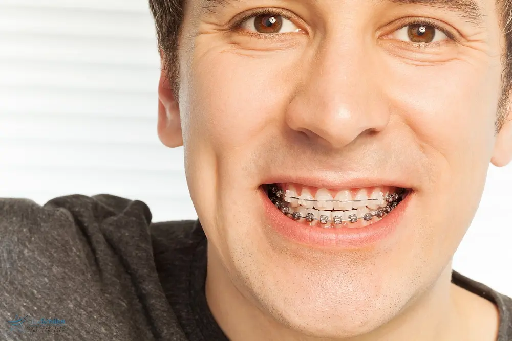 happy young man with metal braces - Overbite vs Underbite in Bloomingdale and Naperville, IL.