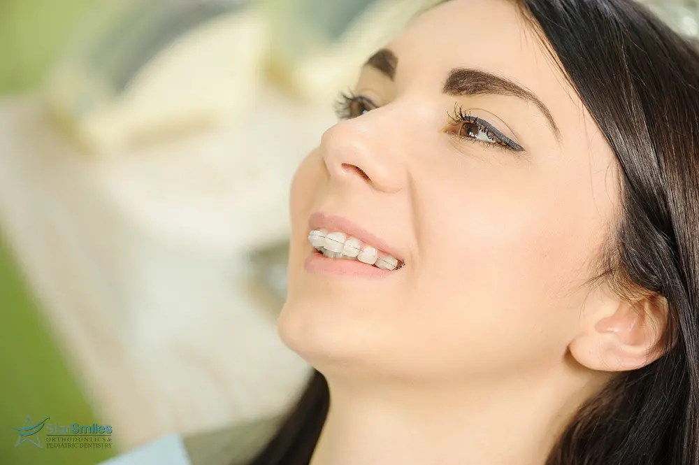 woman with ceramic clear braces on teeth at the dental office - Overbite vs Underbite in Bloomingdale and Naperville, IL.