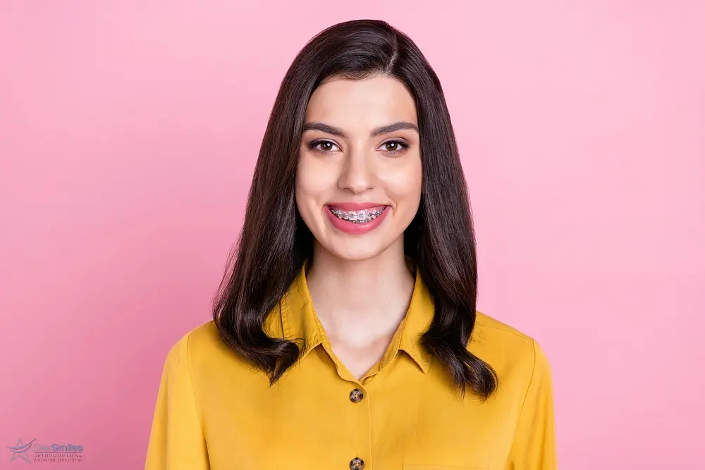 photo of nice optimistic brunette hair young lady wear metal braces - How to Get Braces Glue Off Teeth in Bloomingdale and Naperville, IL 