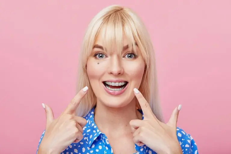 cheerful happy young woman blonde hair gesturing thumb while pointing clear braces - Clear Braces vs Metal Braces in Bloomingdale and Naperville, IL