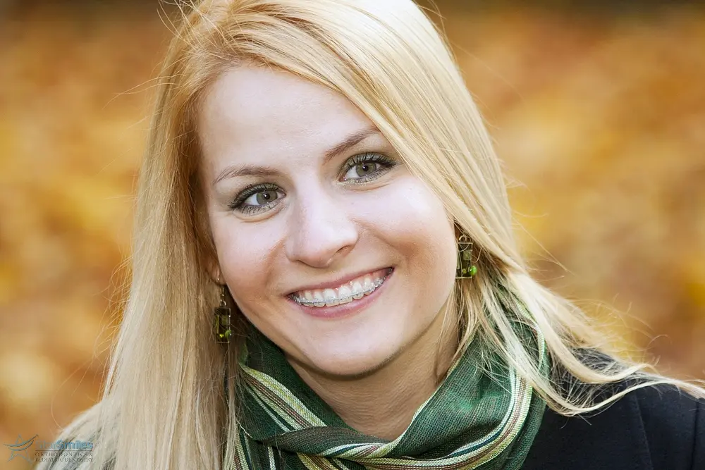 smiling blond young woman with clear braces - Clear Braces vs Metal Braces in Bloomingdale and Naperville, IL 