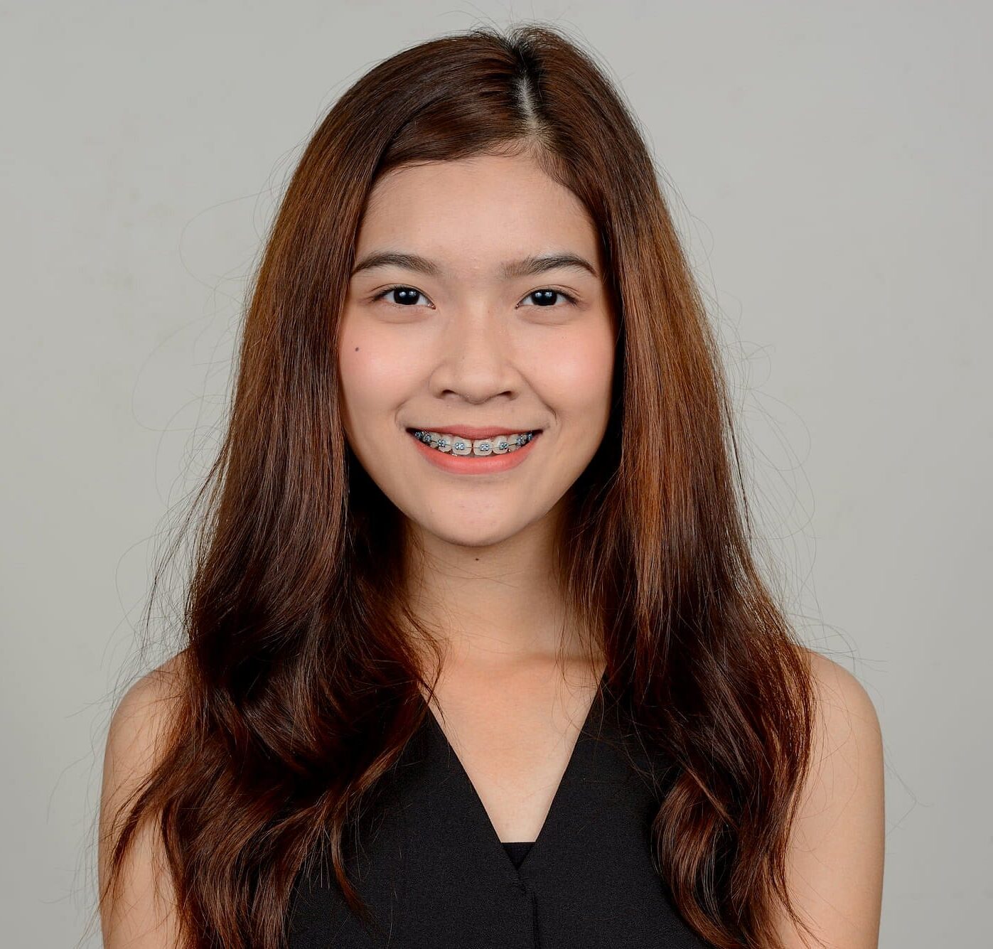A young woman with braces smiles, highlighting the importance of oral care for patients with braces and getting free orthodontic consultation in Bloomingdale, IL.